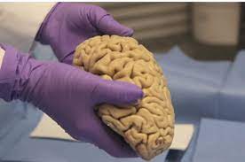مقاله مغز انسان قادر به تولید سلولهای جدید است