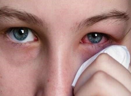 تحقیق بیماری ترومای چشمی